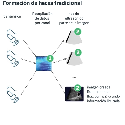 Imagen - Formación de haces tradicionales